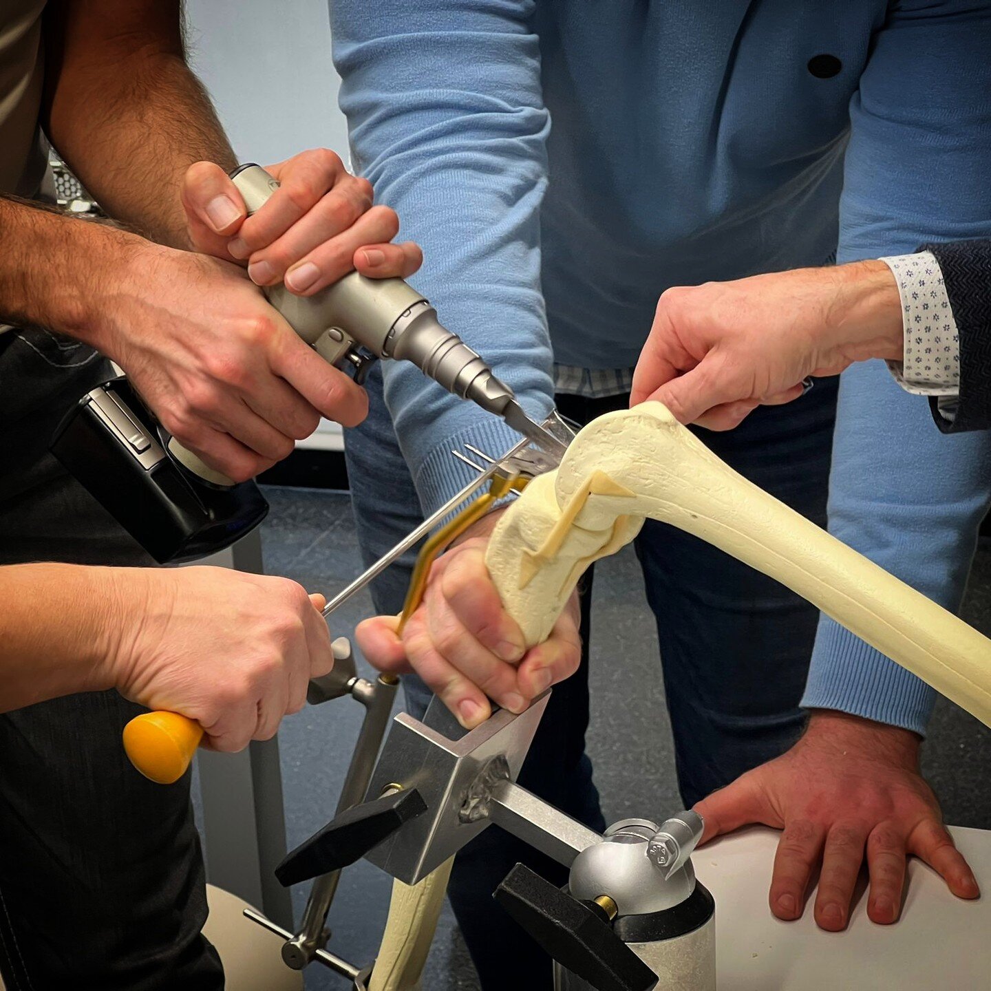 Instrumentació en I’Artroplastia Unicompartimental de Genoll Oxford